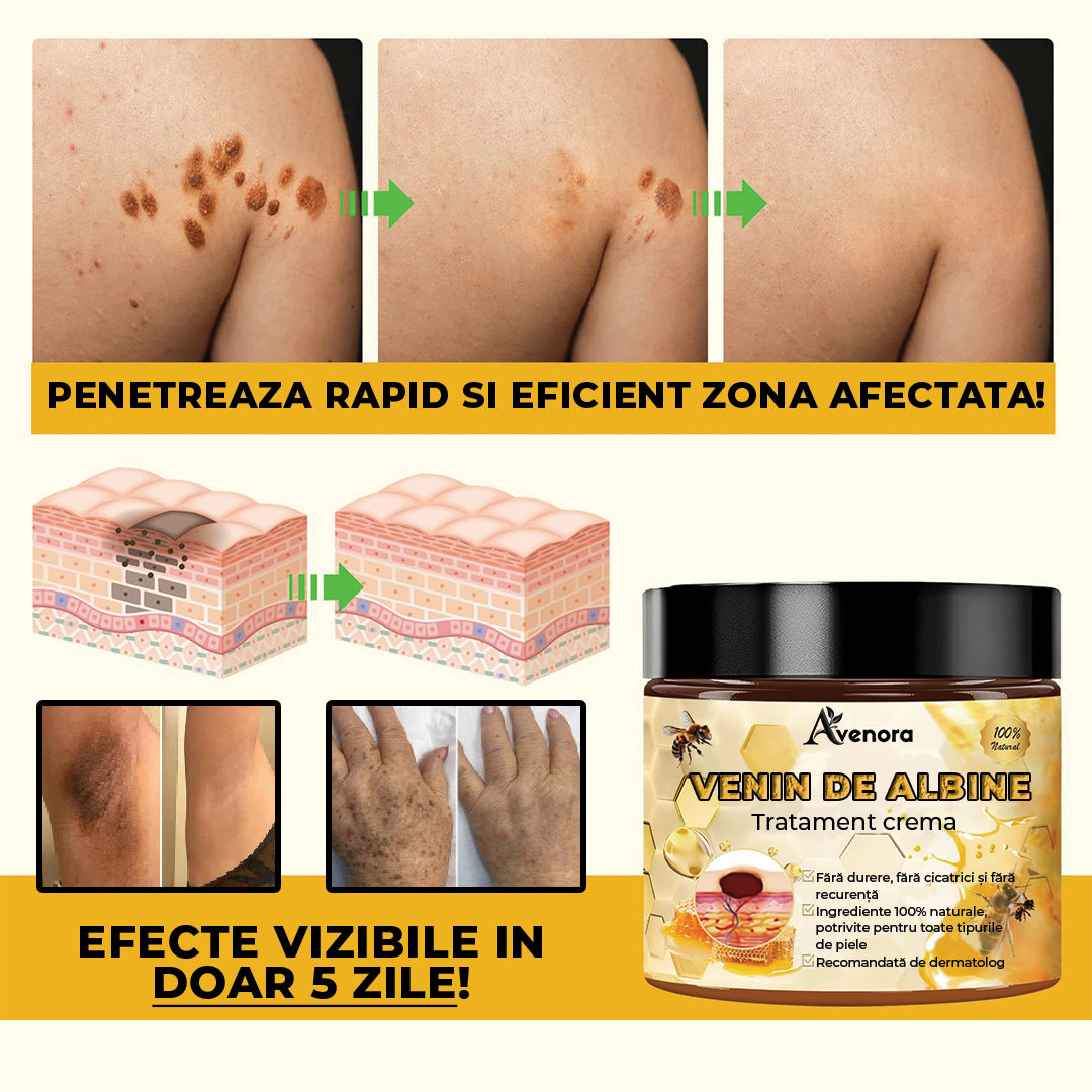 Crema pentru piele cu venin de albine