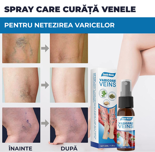 Spray pentru varice