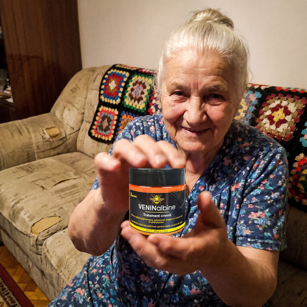 Maria Ionescu, clientă Avenora care folosește crema VENINalbine
