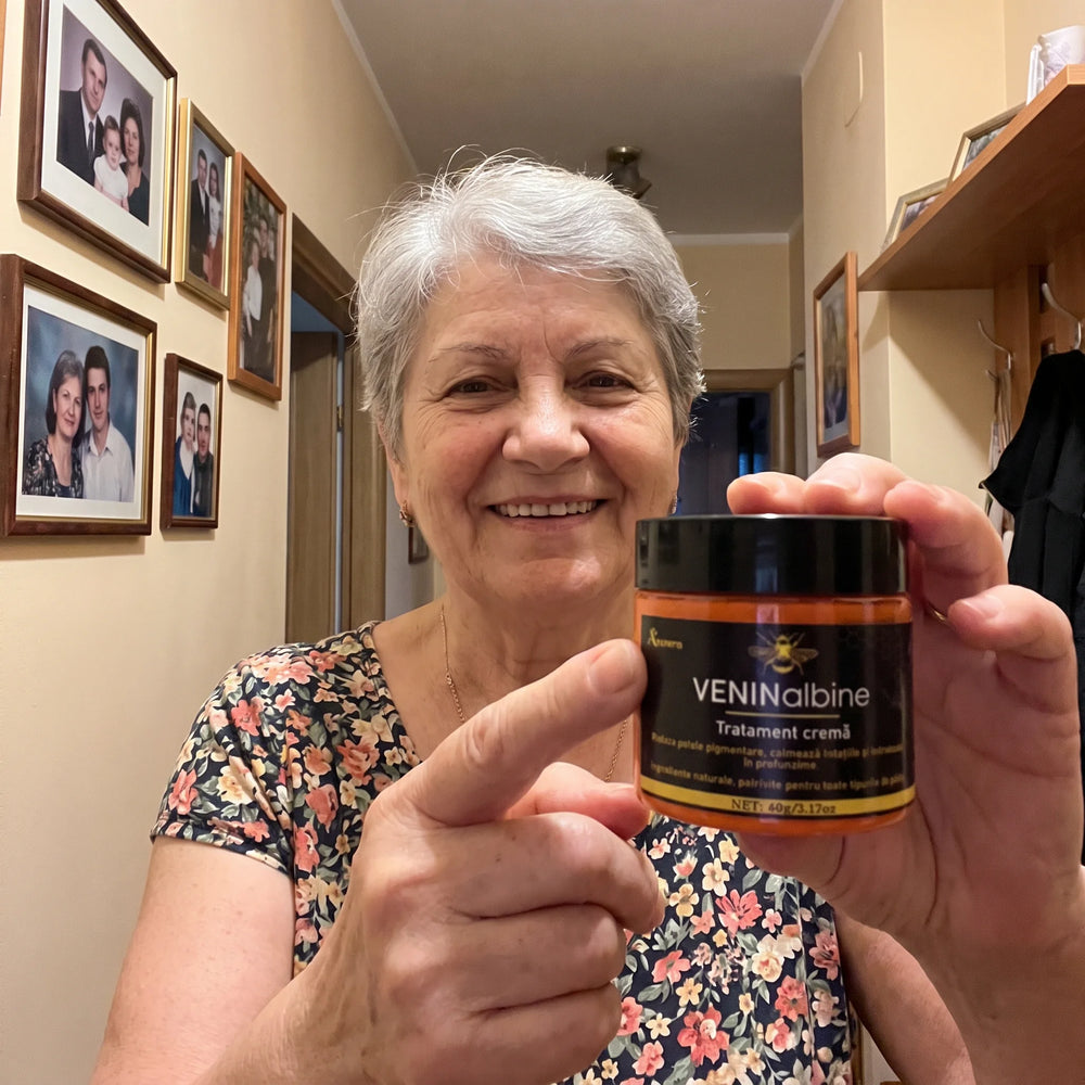 Elisabeta Pop, clientă Avenora care folosește crema VENINalbine